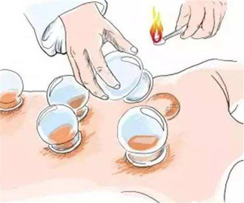 西安有地方可以刮痧，拔罐一起学吗