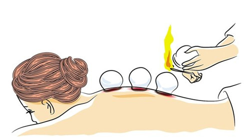 在西安想学习中医理疗，拔罐针灸那个学校比较靠谱